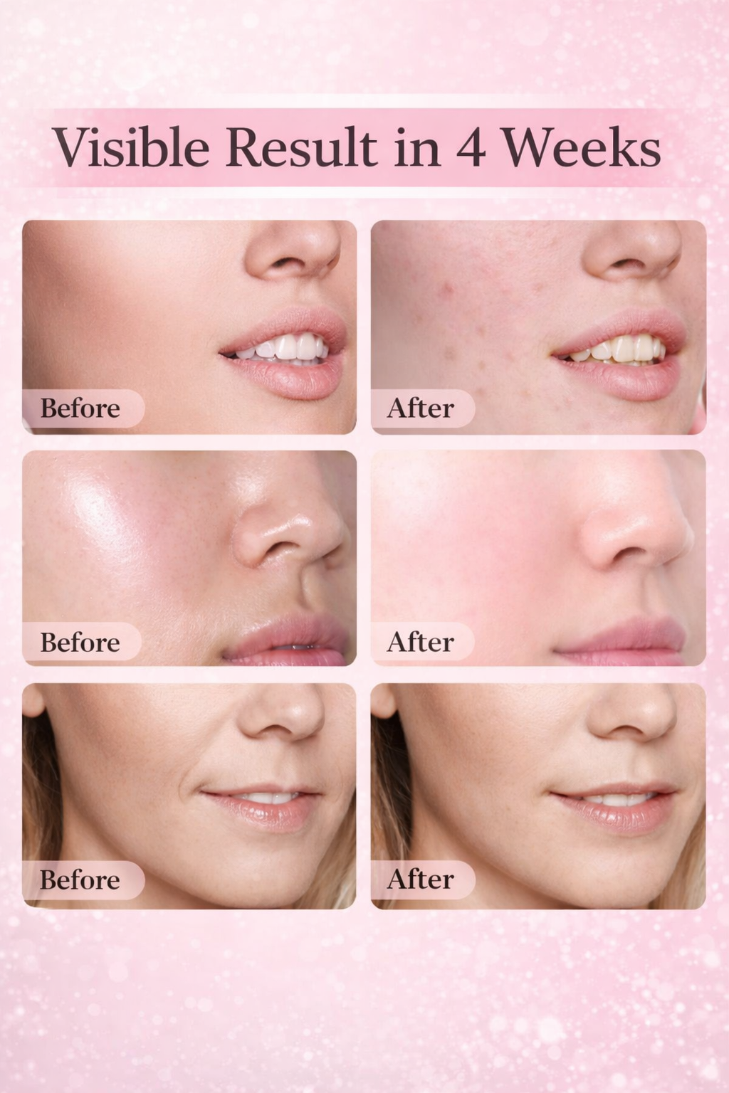 Glowing Skin LED Mask